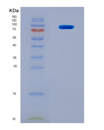 SDS-PAGE analysis of Human SYK (Tyrosine-Protein Kinase Syk) - Recombinant Protein, showing >90% purity under 15% SDS-PAGE (Reduced)