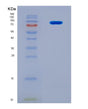 SDS-PAGE analysis of Human SYK (Tyrosine-Protein Kinase Syk) - Recombinant Protein, showing >90% purity under 15% SDS-PAGE (Reduced)