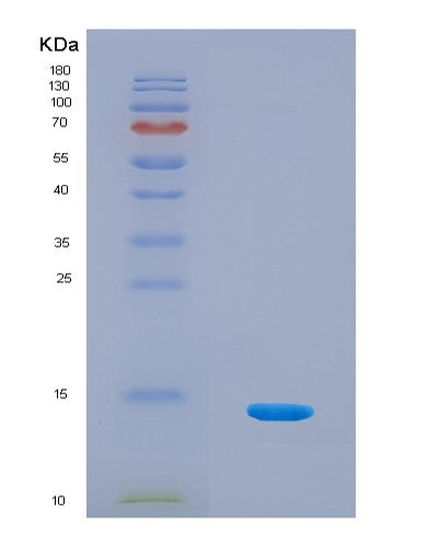 SDS-PAGE analysis of Human SNCA (Alpha-Synuclein) - Recombinant Protein, showing >90% purity under 15% SDS-PAGE (Reduced)