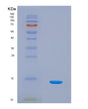 SDS-PAGE analysis of Human SNCA (Alpha-Synuclein) - Recombinant Protein, showing >90% purity under 15% SDS-PAGE (Reduced)