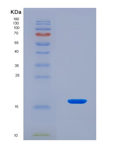 SDS-PAGE analysis of Human Inhibin Beta E (INHbE) - Recombinant Protein, showing >90% purity under 15% SDS-PAGE (Reduced)