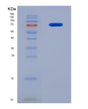 SDS-PAGE analysis of Human FOXO1 (Forkhead Box Protein O1) - Recombinant Protein, showing >90% purity under 15% SDS-PAGE (Reduced)