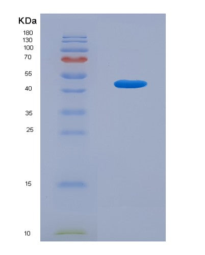 SDS-PAGE analysis of Mouse Mgst1 (Microsomal Glutathione S-Transferase 1) - Recombinant Protein, showing >90% purity under 15% SDS-PAGE (Reduced)