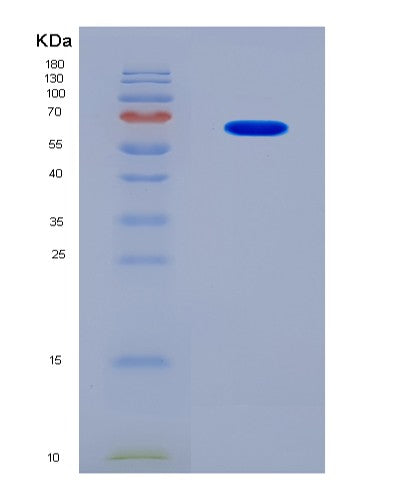 SDS-PAGE analysis of Human CCNE2 (G1/S-Specific Cyclin-E2) - Recombinant Protein, showing >90% purity under 15% SDS-PAGE (Reduced)