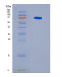 SDS-PAGE analysis of Human METTL3 (N(6)-Adenosine-Methyltransferase Catalytic Subunit Mettl3) - Recombinant Protein, showing >90% purity under 15% SDS-PAGE (Reduced)