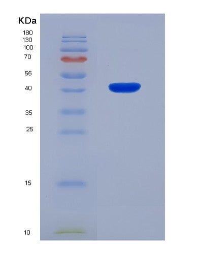 SDS-PAGE analysis of Human HSD17B3 (17-Beta-Hydroxysteroid Dehydrogenase Type 3) - Recombinant Protein, showing >90% purity under 15% SDS-PAGE (Reduced)
