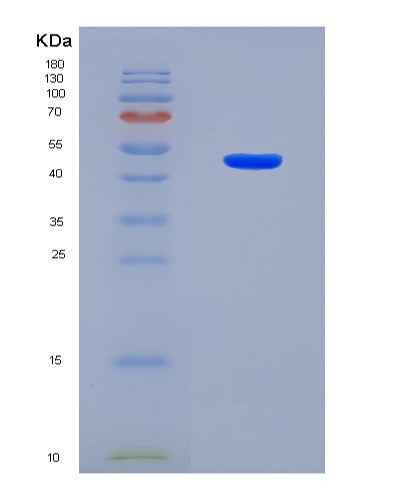 SDS-PAGE analysis of Human CDK8 (Cyclin-Dependent Kinase 8) - Recombinant Protein, showing >90% purity under 15% SDS-PAGE (Reduced)
