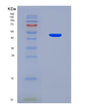 SDS-PAGE analysis of Human CDK8 (Cyclin-Dependent Kinase 8) - Recombinant Protein, showing >90% purity under 15% SDS-PAGE (Reduced)