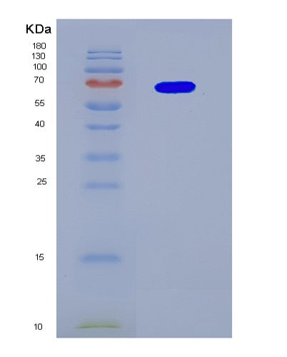 SDS-PAGE analysis of Human MAP2K1 (Dual Specificity Mitogen-Activated Protein Kinase Kinase 1) - Recombinant Protein, showing >90% purity under 15% SDS-PAGE (Reduced)