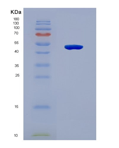 SDS-PAGE analysis of Human CDCA8 (Borealin) - Recombinant Protein, showing >90% purity under 15% SDS-PAGE (Reduced)