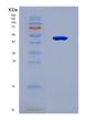 SDS-PAGE analysis of Human CDCA8 (Borealin) - Recombinant Protein, showing >90% purity under 15% SDS-PAGE (Reduced)