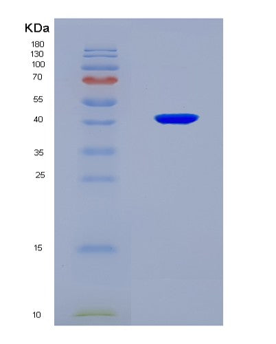 SDS-PAGE analysis of Human RAD51 (Dna Repair Protein Rad51 Homolog 1) - Recombinant Protein, showing >90% purity under 15% SDS-PAGE (Reduced)