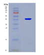 SDS-PAGE analysis of Human RAD51 (Dna Repair Protein Rad51 Homolog 1) - Recombinant Protein, showing >90% purity under 15% SDS-PAGE (Reduced)