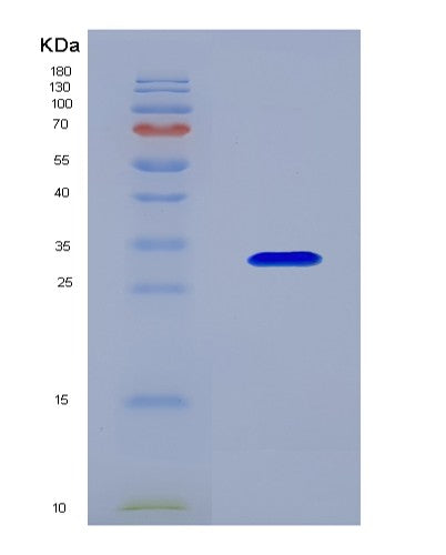 SDS-PAGE analysis of Human COL4A1 (Collagen Alpha-1(Iv) Chain) - Recombinant Protein, showing >90% purity under 15% SDS-PAGE (Reduced)