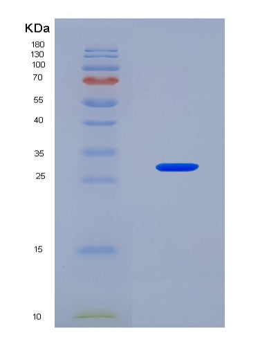 SDS-PAGE analysis of Human COL4A2 (Collagen Alpha-2(Iv) Chain) - Recombinant Protein, showing >90% purity under 15% SDS-PAGE (Reduced)