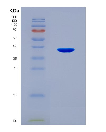 SDS-PAGE analysis of Human HSD11B2 (11-Beta-Hydroxysteroid Dehydrogenase Type 2) - Recombinant Protein, showing >90% purity under 15% SDS-PAGE (Reduced)