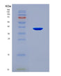SDS-PAGE analysis of Human HSD11B2 (11-Beta-Hydroxysteroid Dehydrogenase Type 2) - Recombinant Protein, showing >90% purity under 15% SDS-PAGE (Reduced)