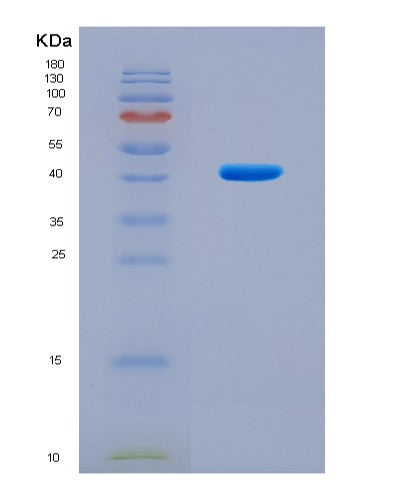 SDS-PAGE analysis of Human ERBB2 (Receptor Tyrosine-Protein Kinase Erbb-2) - Recombinant Protein, CAT# BLT-08471P showing >95% purity under 15% SDS-PAGE (Reduced)
