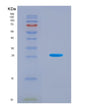 SDS-PAGE analysis of Human PFKP (Atp-Dependent 6-Phosphofructokinase, Platelet Type) - Recombinant Protein, CAT# BLT-08472P showing >90% purity under 15% SDS-PAGE (Reduced)