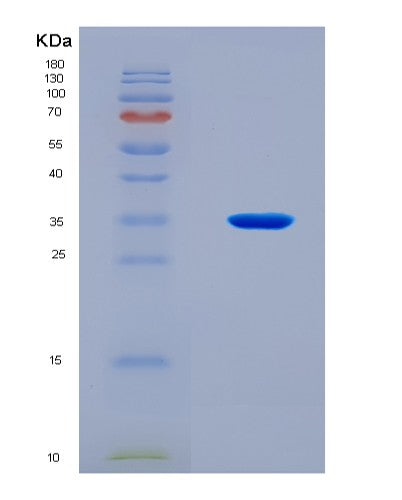 SDS-PAGE analysis of Human NEIL1 (Endonuclease 8-Like 1) - Recombinant Protein, CAT# BLT-08476P showing >90% purity under 15% SDS-PAGE (Reduced)