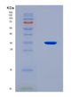 SDS-PAGE analysis of Human NEIL1 (Endonuclease 8-Like 1) - Recombinant Protein, CAT# BLT-08476P showing >90% purity under 15% SDS-PAGE (Reduced)
