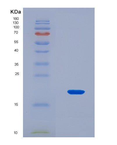 SDS-PAGE analysis of Mouse Col8a1 (Collagen Alpha-1(Viii) Chain) - Recombinant Protein, CAT# BLT-08478P showing >90% purity under 15% SDS-PAGE (Reduced)