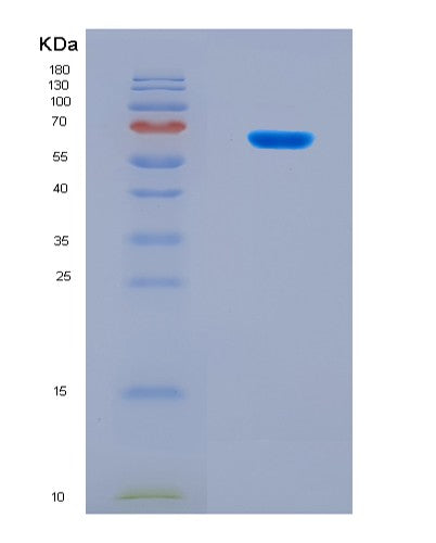 SDS-PAGE analysis of Mouse Lars1 (Leucine--Trna Ligase, Cytoplasmic) - Recombinant Protein, CAT# BLT-08479P showing >90% purity under 15% SDS-PAGE (Reduced)