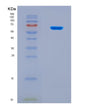 SDS-PAGE analysis of Mouse Lars1 (Leucine--Trna Ligase, Cytoplasmic) - Recombinant Protein, CAT# BLT-08479P showing >90% purity under 15% SDS-PAGE (Reduced)