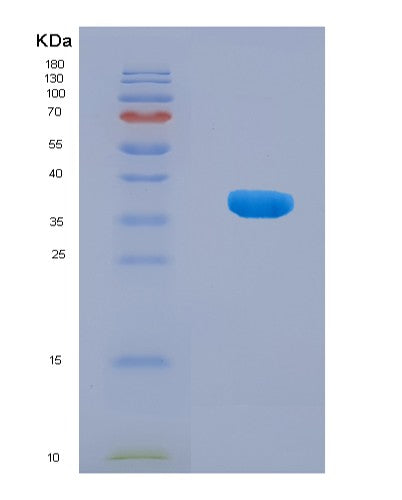 SDS-PAGE analysis of Human G3BP1 (Ras Gtpase-Activating Protein-Binding Protein 1) - Recombinant Protein, CAT# BLT-08482P showing >90% purity under 15% SDS-PAGE (Reduced)