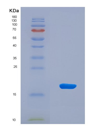 SDS-PAGE analysis of Human SNRPD1 (Small Nuclear Ribonucleoprotein Sm D1) - Recombinant Protein, CAT# BLT-08484P showing >90% purity under 15% SDS-PAGE (Reduced)