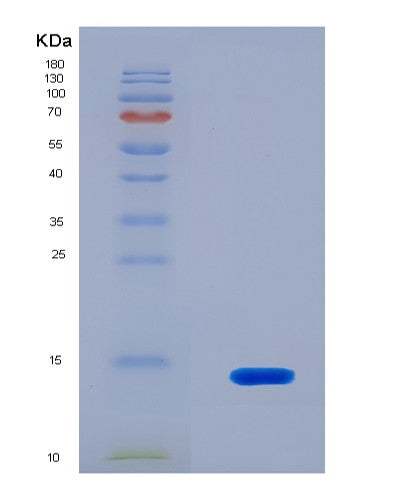SDS-PAGE analysis of Human PIGR (Polymeric Immunoglobulin Receptor) - Recombinant Protein, CAT# BLT-08487P showing >90% purity under 15% SDS-PAGE (Reduced)