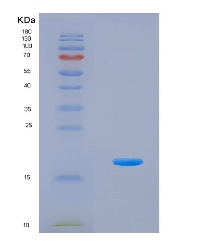 SDS-PAGE analysis of Human CNTN5 (Contactin-5) - Recombinant Protein, CAT# BLT-08488P showing >90% purity under 15% SDS-PAGE (Reduced)