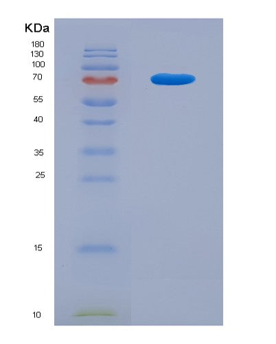 SDS-PAGE analysis of Human HSPA9 (Stress-70 Protein, Mitochondrial) - Recombinant Protein, CAT# BLT-08489P showing >90% purity under 15% SDS-PAGE (Reduced)