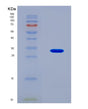 SDS-PAGE analysis of Human JAK3 (Tyrosine-Protein Kinase Jak3) - Recombinant Protein, CAT# BLT-08491P showing >90% purity under 15% SDS-PAGE (Reduced)