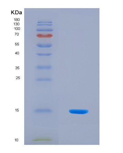SDS-PAGE analysis of Human NPY2R (Neuropeptide Y Receptor Type 2) - Recombinant Protein, CAT# BLT-08492P showing >90% purity under 15% SDS-PAGE (Reduced)
