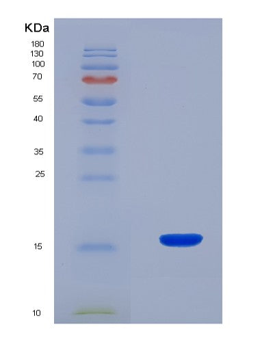 SDS-PAGE analysis of Mouse Rspo1 (R-Spondin-1) - Recombinant Protein, CAT# BLT-08495P showing >90% purity under 15% SDS-PAGE (Reduced)