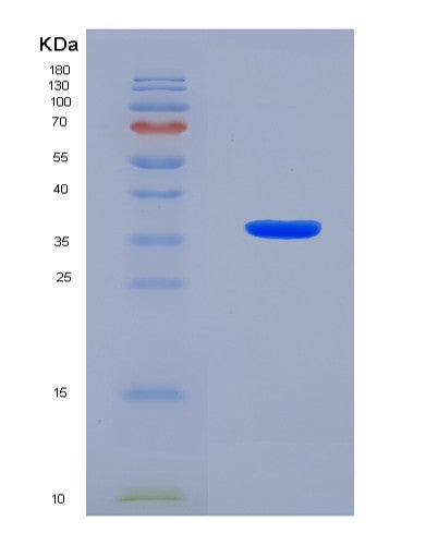 SDS-PAGE analysis of Human KRT18 (Keratin, Type I Cytoskeletal 18) - Recombinant Protein, CAT# BLT-08496P showing >90% purity under 15% SDS-PAGE (Reduced)