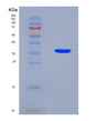 SDS-PAGE analysis of Human KRT18 (Keratin, Type I Cytoskeletal 18) - Recombinant Protein, CAT# BLT-08496P showing >90% purity under 15% SDS-PAGE (Reduced)