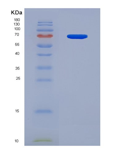SDS-PAGE analysis of Human BDKRB2 (B2 Bradykinin Receptor) - Recombinant Protein, CAT# BLT-08497P showing >90% purity under 15% SDS-PAGE (Reduced)