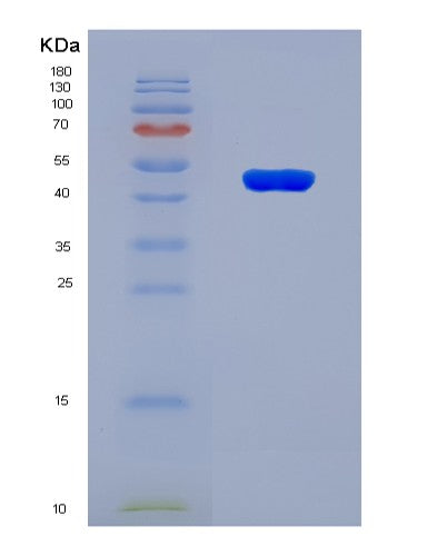 SDS-PAGE analysis of Human MAT2A (S-Adenosylmethionine Synthase Isoform Type-2) - Recombinant Protein, CAT# BLT-08498P showing >90% purity under 15% SDS-PAGE (Reduced)