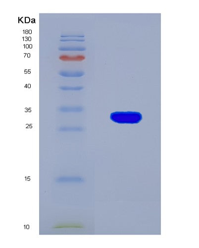 SDS-PAGE analysis of Mouse Hif1a (Hypoxia-Inducible Factor 1-Alpha) - Recombinant Protein, CAT# BLT-08500P showing >90% purity under 15% SDS-PAGE (Reduced)