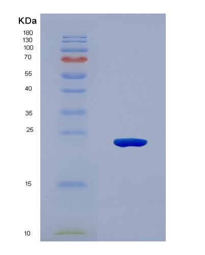 SDS-PAGE analysis of Mouse Il11 (Interleukin-11) - Recombinant Protein, CAT# BLT-08501P showing >90% purity under 15% SDS-PAGE (Reduced)