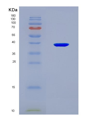 SDS-PAGE analysis of Human HSD17B2 (17-Beta-Hydroxysteroid Dehydrogenase Type 2) - Recombinant Protein, CAT# BLT-08502P showing >90% purity under 15% SDS-PAGE (Reduced)