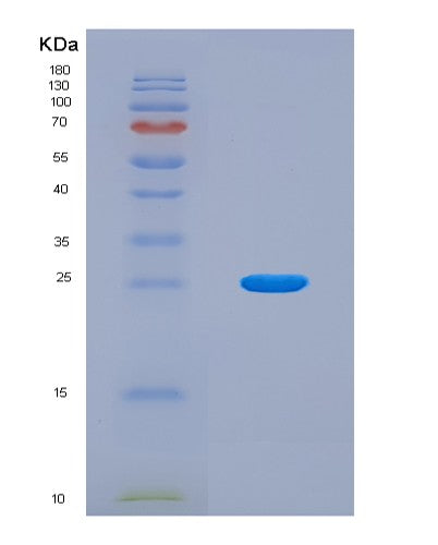 SDS-PAGE analysis of Mouse Il22ra2 (Interleukin-22 Receptor Subunit Alpha-2) - Recombinant Protein, CAT# BLT-08503P showing >90% purity under 15% SDS-PAGE (Reduced)