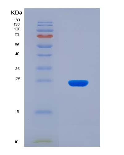 SDS-PAGE analysis of Human ITGAV (Integrin Alpha-V) - Recombinant Protein, CAT# BLT-08505P showing >90% purity under 15% SDS-PAGE (Reduced)