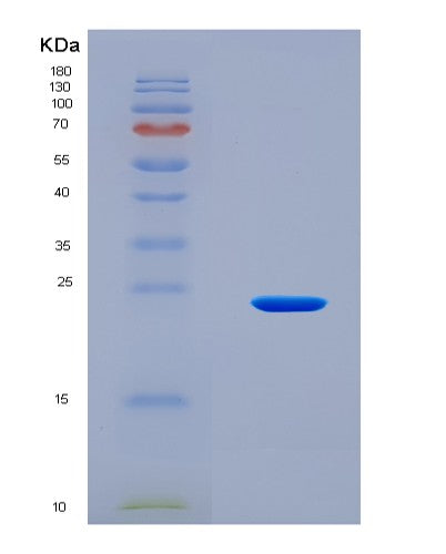SDS-PAGE analysis of Mouse Mmp1a (Interstitial Collagenase A) - Recombinant Protein, CAT# BLT-08507P showing >90% purity under 15% SDS-PAGE (Reduced)