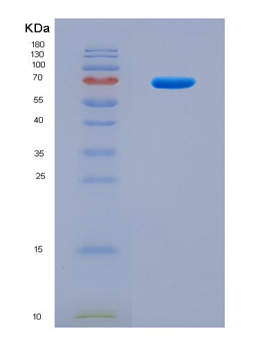 SDS-PAGE analysis of Human OPTN (Optineurin) - Recombinant Protein, CAT# BLT-08509P showing >90% purity under 15% SDS-PAGE (Reduced)
