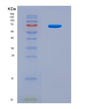 SDS-PAGE analysis of Human OPTN (Optineurin) - Recombinant Protein, CAT# BLT-08509P showing >90% purity under 15% SDS-PAGE (Reduced)