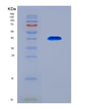 SDS-PAGE analysis of Human ACOT8 (Acyl-Coenzyme A Thioesterase 8) - Recombinant Protein, CAT# BLT-08513P showing >90% purity under 15% SDS-PAGE (Reduced)
