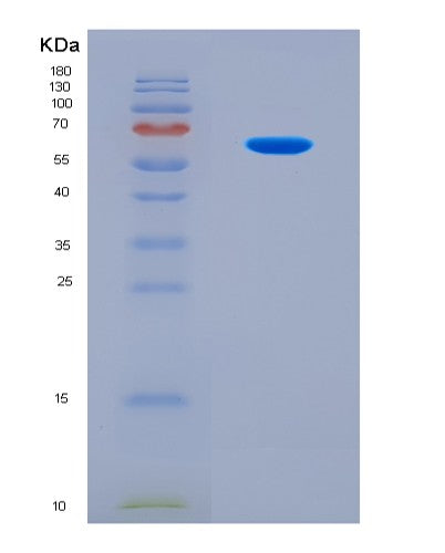 SDS-PAGE analysis of Human MMP14 (Matrix Metalloproteinase-14) - Recombinant Protein, CAT# BLT-08516P showing >90% purity under 15% SDS-PAGE (Reduced)